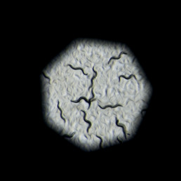 C. elegans seen through a microscope